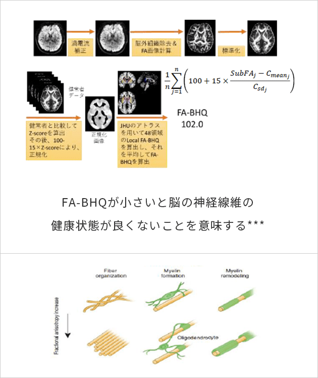 脳の神経線維の健康状態の指標を表した図